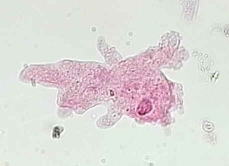 amoeba genus